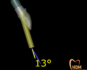 Angled screw channel